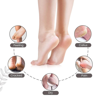 ZACVIN Foot Scrubber for Dead Skin Filer